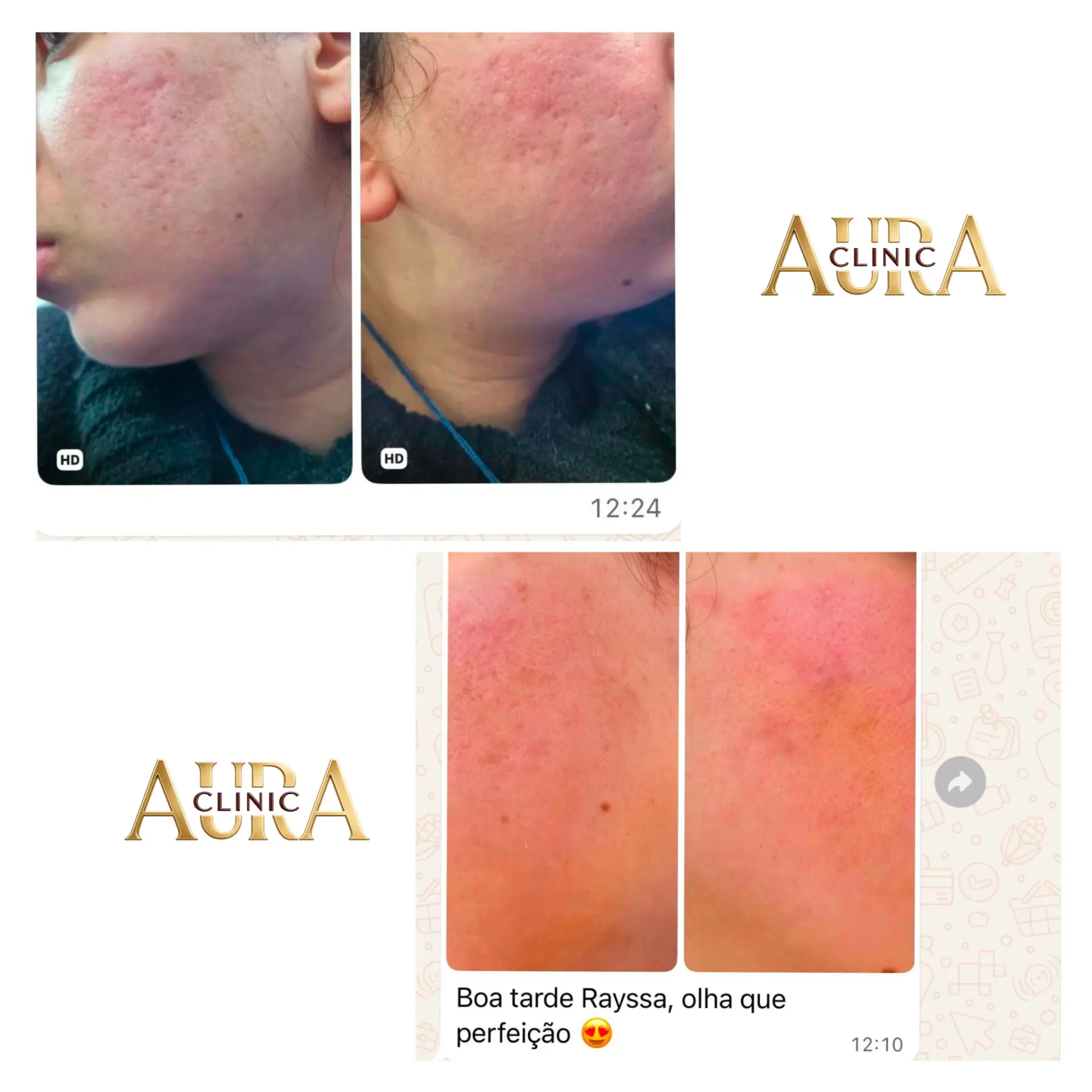 Feedback recebido de cliente da Aura Clinic sobre a evolução da pele